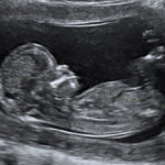 Planned Parenthood announces plans for mobile abortion clinic